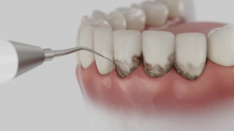 Trusted Invisalign Clear Aligners service in Newcastle, OK - Dentist Open Now